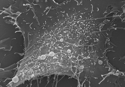 ブドウ球菌に感染した線維芽細胞の表面（筆者撮影）