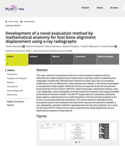 本学教員が新たな足部骨配列の評価法を開発<br/>精度、再現性、コスト、扱い易さなどに優れた手法として期待